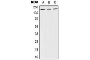Western blot analysis of BRCA1 (pS1524) expression in A431 (A), NIH3T3 (B), PC12 (C) whole cell lysates. (BRCA1 anticorps  (C-Term, pSer1524))