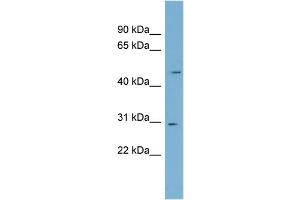 WB Suggested Anti-NDUFS3 Antibody Titration: 0. (NDUFS3 anticorps  (Middle Region))