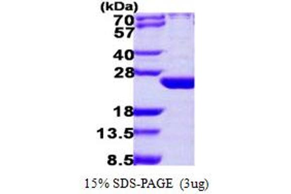 ARL6 Protein (AA 1-186) (His tag)