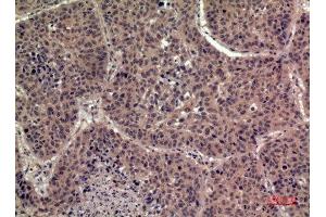 Immunohistochemistry (IHC) analysis of paraffin-embedded Human Lung, antibody was diluted at 1:100. (FIL1h anticorps  (Internal Region))