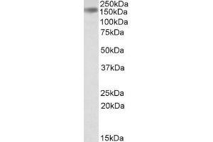 ABIN334479 (0. (DROSHA anticorps  (Internal Region))