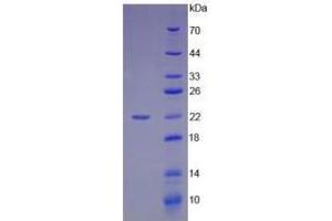 Image no. 1 for High Mobility Group Box 1 (HMGB1) (AA 9-163) (Active) protein (His tag) (ABIN6239874) (HMGB1 Protein (AA 9-163) (His tag))