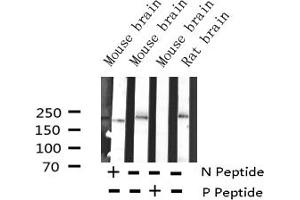 Western blot analysis of Phospho-BRCA1 (Ser1524) Antibody expression in mouse brain and rat brain tissues lysates. (BRCA1 anticorps  (pSer1524))