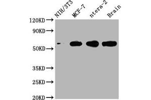 Western Blot Positive WB detected in: NIH/3T3 whole cell lysate, MCF-7 whole cell lysate, ntera-2 whole cell lysate, Mouse brain tissue All lanes: PAK1 antibody at 1:2000 Secondary Goat polyclonal to rabbit IgG at 1/50000 dilution Predicted band size: 61, 62 kDa Observed band size: 61 kDa (Recombinant PAK1 anticorps)