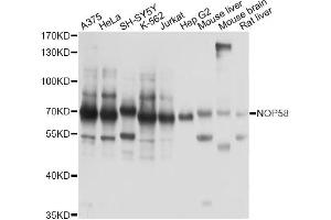 Western blot analysis of extracts of various cell lines, using NOP58 antibody. (NOP58 anticorps)