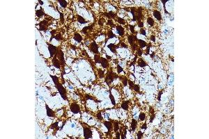 Immunohistochemistry of paraffin-embedded mouse brain using Parvalbumin (PVALB) (PVALB) Rabbit mAb (ABIN7269182) at dilution of 1:100 (40x lens). (PVALB anticorps)