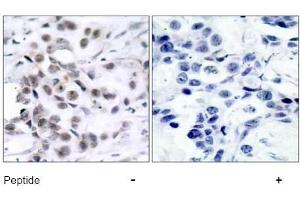 Image no. 1 for anti-Checkpoint Kinase 1 (CHEK1) (Ser317) antibody (ABIN197292) (CHEK1 anticorps  (Ser317))