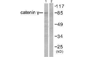 Western blot analysis of extracts from HeLa cells, using Catenin-γ antibody. (JUP anticorps)