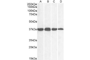 Western Blotting (WB) image for anti-Glyceraldehyde-3-Phosphate Dehydrogenase (GAPDH) (C-Term) antibody (ABIN185240)