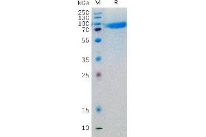 Human IL6R Protein, hFc Tag on SDS-PAGE under reducing condition. (IL-6 Receptor Protein (AA 20-365) (Fc Tag))