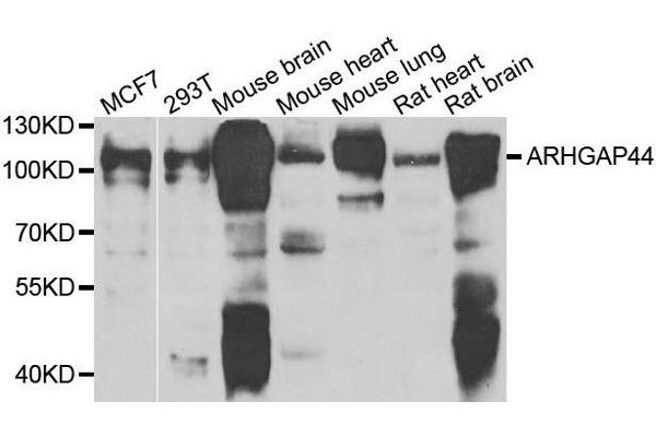 ARHGAP44 anticorps  (AA 666-772)