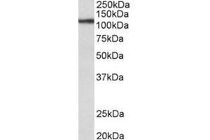 AP31686PU-N (0. (Thyroperoxidase anticorps  (Internal Region))