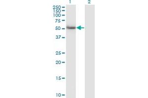 Western Blot analysis of CALCOCO2 expression in transfected 293T cell line by CALCOCO2 monoclonal antibody (M07), clone 1A11. (CALCOCO2 anticorps  (AA 347-446))