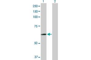 Lane 1: CCT6B transfected lysate ( 57. (CCT6B 293T Cell Transient Overexpression Lysate(Denatured))