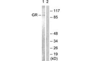 Western Blotting (WB) image for anti-Nuclear Receptor Subfamily 3, Group C, Member 1 (Glucocorticoid Receptor) (NR3C1) (AA 201-250) antibody (ABIN2888632) (Glucocorticoid Receptor anticorps  (AA 201-250))