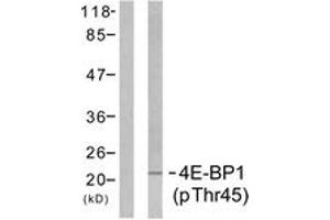 Western blot analysis of extracts from MDA-MB-435 cells treated with EGF 200ng/ml 5', using 4E-BP1 (Phospho-Thr45) Antibody. (eIF4EBP1 anticorps  (pThr46))