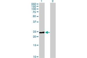 Western Blot analysis of HYAL1 expression in transfected 293T cell line by HYAL1 MaxPab polyclonal antibody. (HYAL1 anticorps  (AA 1-253))