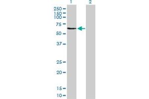 Western Blot analysis of OMD expression in transfected 293T cell line by OMD MaxPab polyclonal antibody. (Osteomodulin anticorps  (AA 1-421))