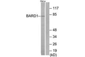 Western Blotting (WB) image for anti-BRCA1 Associated RING Domain 1 (BARD1) (AA 1-50) antibody (ABIN2889977) (BARD1 anticorps  (AA 1-50))