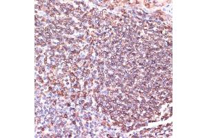 Immunohistochemistry of paraffin-embedded human tonsil using TPD52 antibody  at dilution of 1:100 (40x lens). (TPD52 anticorps  (AA 1-184))