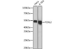 Western blot analysis of extracts of various cell lines, using FOXL2 Rabbit mAb (ABIN1682615, ABIN7101527, ABIN7101528 and ABIN7101529) at 1:1000 dilution. (FOXL2 anticorps)
