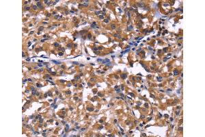 Immunohistochemistry (IHC) image for anti-Selectin P Ligand (SELPLG) antibody (ABIN2422075) (SELPLG anticorps)