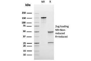 SDS-PAGE Analysis Purified BCL-6 Mouse Recombinant Monoclonal Antibody (rBCL6/1718). (Recombinant BCL6 anticorps  (AA 256-389))