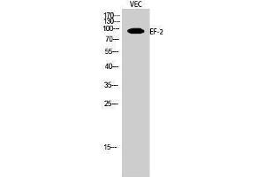 Western Blotting (WB) image for anti-Eukaryotic Translation Elongation Factor 2 (EEF2) (Ser311) antibody (ABIN3184410) (EEF2 anticorps  (Ser311))