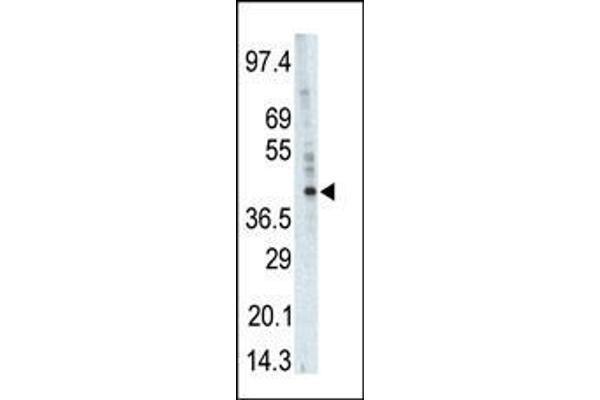 PHKG1 anticorps  (AA 302-332)