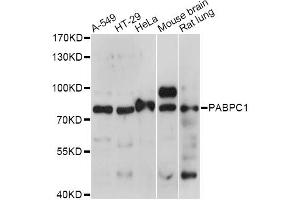 Western blot analysis of extracts of various cell lines, using PABPC1 antibody. (PC1 anticorps)