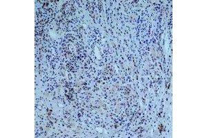 Immunohistochemical analysis of Collagen 3 alpha 1 staining in human skin formalin fixed paraffin embedded tissue section. (COL3A1 anticorps)