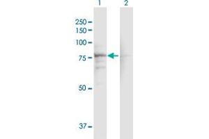Western Blot analysis of CACNB1 expression in transfected 293T cell line by CACNB1 MaxPab polyclonal antibody. (CACNB1 anticorps  (AA 1-598))