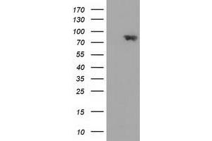 HEK293T cells were transfected with the pCMV6-ENTRY control (Left lane) or pCMV6-ENTRY MAPK7 (Right lane) cDNA for 48 hrs and lysed. (MAPK7 anticorps)