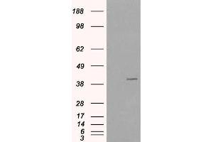 Western Blotting (WB) image for anti-Vacuolar Protein Sorting-Associated Protein 26A (VPS26A) antibody (ABIN5906188) (VPS26A anticorps)