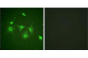 Immunofluorescence analysis of HepG2 cells, using HDAC6 (Ab-22) Antibody. (HDAC6 anticorps  (AA 7-56))