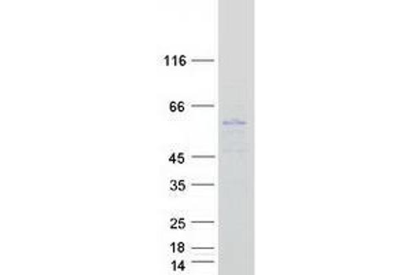 TMEM79 Protein (Transcript Variant 1) (Myc-DYKDDDDK Tag)