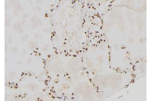 ABIN6277592 at 1/100 staining Human lung tissue by IHC-P. (PER3 anticorps  (Internal Region))