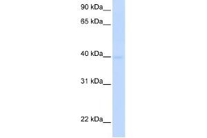 SLC25A36 antibody used at 1 ug/ml to detect target protein. (SLC25A36 anticorps  (N-Term))