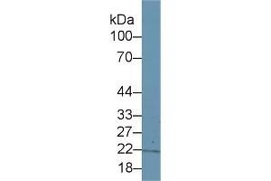 Western blot analysis of Human Lung lysate, using Human ITPA Antibody (1 µg/ml) and HRP-conjugated Goat Anti-Rabbit antibody ( (ITPA anticorps  (AA 3-180))