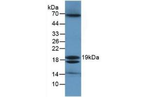 Detection of ECO in Ecoli Cells using Polyclonal Antibody to Ecotin (ECO) (Ecotin (AA 21-162) anticorps)