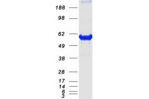 Validation with Western Blot (Catalase Protein (CAT) (Myc-DYKDDDDK Tag))