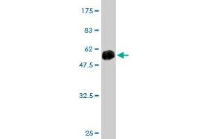 Western Blot detection against Immunogen (49. (TRAPPC4 anticorps  (AA 1-219))