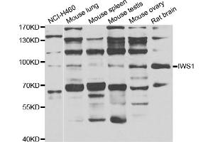 Western blot analysis of extracts of various cell lines, using IWS1 antibody (ABIN4904098) at 1:1000 dilution. (IWS1 anticorps)