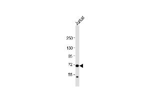 Anti-HAUS5 Antibody (N-term) at 1:1000 dilution + Jurkat whole cell lysate Lysates/proteins at 20 μg per lane. (HAUS5 anticorps  (N-Term))