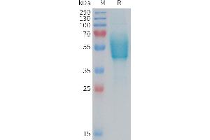 Human Protein, hFc Tag on SDS-PAGE under reducing condition. (CALCRL Protein (AA 23-140) (Fc Tag))