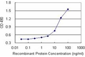 Sandwich ELISA detection sensitivity ranging from 0. (PDLIM1 (Humain) Matched Antibody Pair)