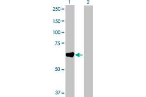 Western Blot analysis of GAD2 expression in transfected 293T cell line by GAD2 MaxPab polyclonal antibody. (GAD65 anticorps  (AA 1-585))
