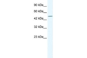 TPTE antibody used at 1. (TPTE anticorps  (C-Term))