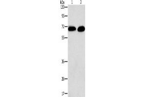 Western Blotting (WB) image for anti-Protein Kinase C, alpha (PKCa) antibody (ABIN2434183) (PKC alpha anticorps)