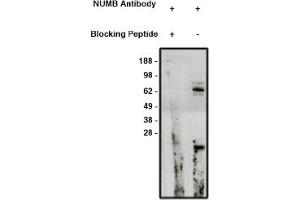 Image no. 1 for anti-Numb Homolog (NUMB) antibody (ABIN4620367) (NUMB anticorps)